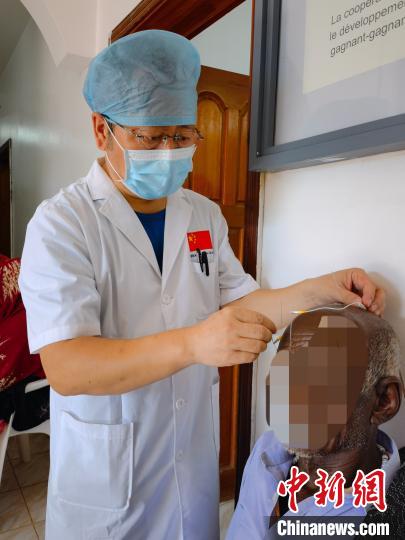 中医针灸缓解疼痛山西援外医生用中国传统医学服务吉布提患者